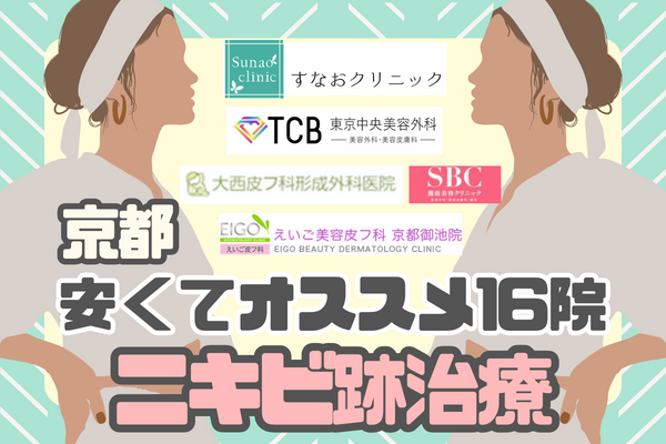 京都でニキビ跡治療が安いおすすめクリニック16院！治療法ごとの料金も比較